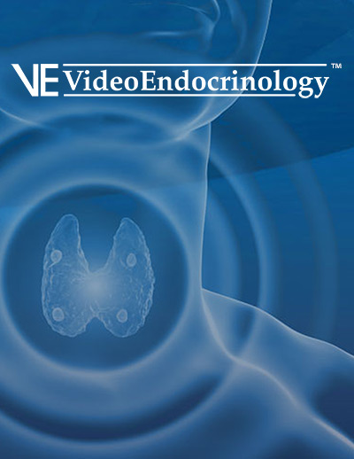 Radiofrequency Ablation is a sparing technique for treatment of intrathyroidal parathyroid adenoma